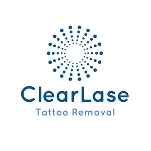 clearlasetattooremoval