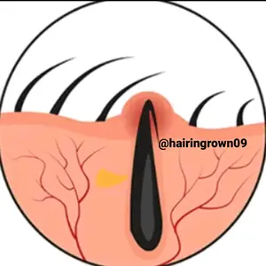 hairingrown09 thumbnail